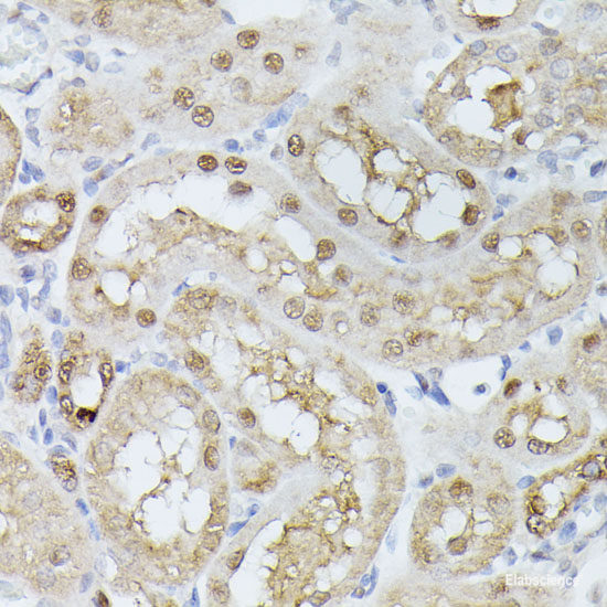 Immunofluorescence analysis of U2OS cells using MonoMethyl-UHRF1-K385 Polyclonal Antibody at dilution of 1:100. Blue: DAPI for nuclear staining.