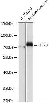 Immunofluorescence analysis of U2OS cells using SH2D1B Polyclonal Antibody at dilution of 1:100. Blue: DAPI for nuclear staining.