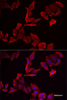 Immunofluorescence analysis of U2OS cells using DiMethyl-DNMT3A-K44 Polyclonal Antibody at dilution of 1:100. Blue: DAPI for nuclear staining.