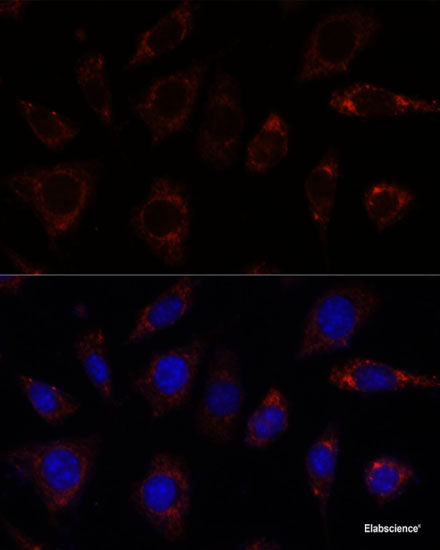 Western blot analysis of extracts of various cell lines using CHRM3 Polyclonal Antibody at dilution of 1:3000.