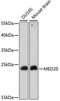 Immunohistochemistry of paraffin-embedded Human breast cancer using LAMC1 Polyclonal Antibody at dilution of 1:100 (40x lens).