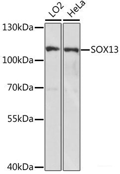 Immunohistochemistry of paraffin-embedded Rat kidney using RARB Polyclonal Antibody at dilution of 1:100 (40x lens).
