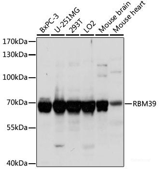 Immunofluorescence analysis of L929 cells using ABCD2 Polyclonal Antibody at dilution of 1:100 (40x lens). Blue: DAPI for nuclear staining.