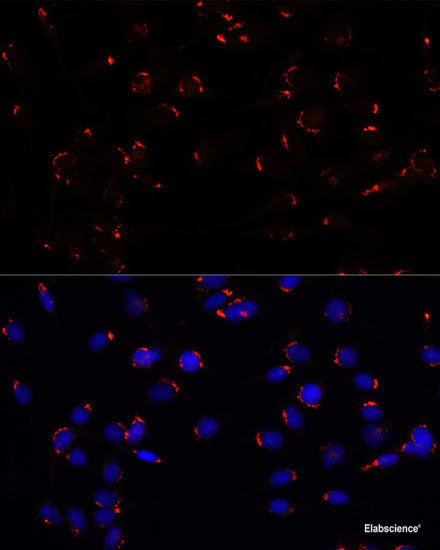 Immunohistochemistry of paraffin-embedded Rat ovary using ASNS Polyclonal Antibody at dilution of 1:100 (40x lens).
