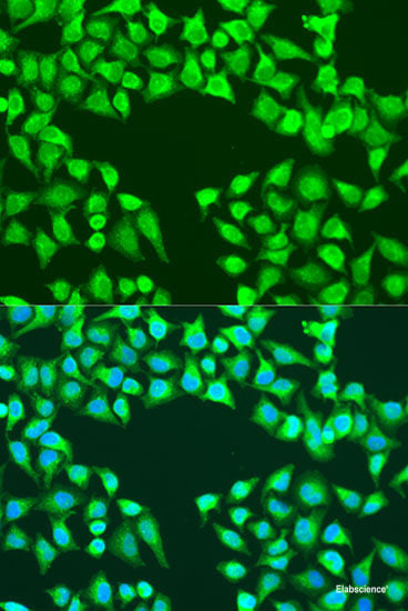 Western blot analysis of extracts of Mouse heart using CACNB2 Polyclonal Antibody at dilution of 1:1000.