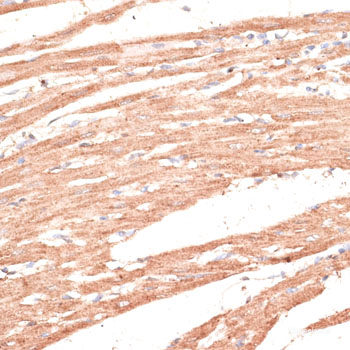 Immunohistochemistry of paraffin-embedded Rat brain using IGHMBP2 Polyclonal Antibody at dilution of 1:100 (40x lens).