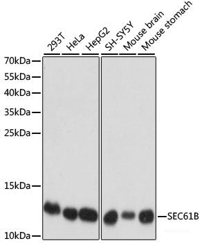 Immunohistochemistry of paraffin-embedded Rat liver using MAP3K1 Polyclonal Antibody at dilution of 1:100 (40x lens).
