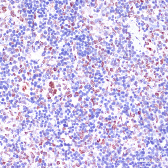 Immunohistochemistry of paraffin-embedded Rat ovary using TRIM27 Polyclonal Antibody at dilution of 1:100 (40x lens).