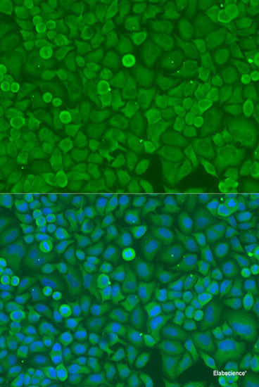 Immunohistochemistry of paraffin-embedded Rat brain using SLC18A3 Polyclonal Antibody at dilution of 1:200 (40x lens).