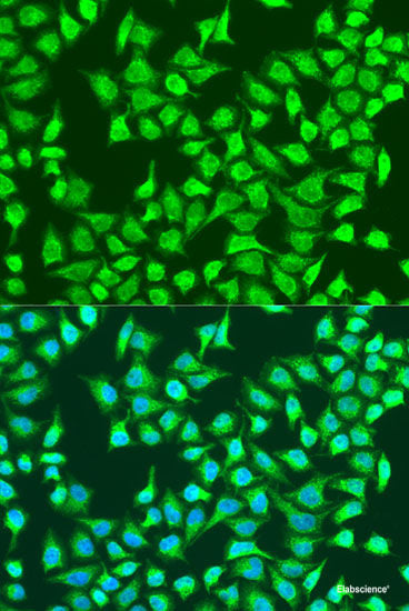 Immunohistochemistry of paraffin-embedded Rat lymph node using CCDC6 Polyclonal Antibody at dilution of 1:100 (40x lens).