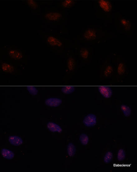Immunohistochemistry of paraffin-embedded Rat liver using MLF2 Polyclonal Antibody at dilution of 1:100 (40x lens).