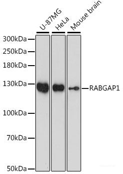 Western blot analysis of extracts of various cell lines using Acetyl-Histone H3-K4 Polyclonal Antibody at dilution of 1:1000. NIH/3T3 cells were treated by TSA (1 uM) at 37°C for 18 hours. C6 cells were treated by TSA (1 uM) at 37°C for 18 hours.