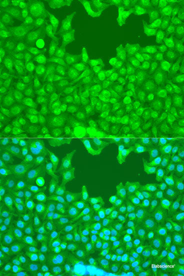 Western blot analysis of extracts of various cell lines using USO1 Polyclonal Antibody at dilution of 1:1000.