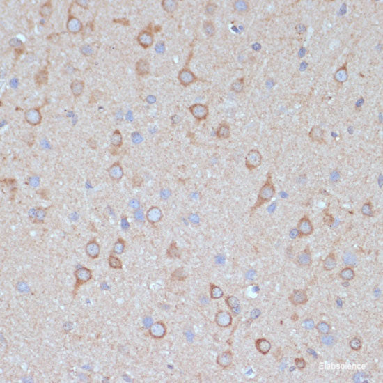 Immunofluorescence analysis of L929 cells using SEC24D Polyclonal Antibody at dilution of 1:100. Blue: DAPI for nuclear staining.
