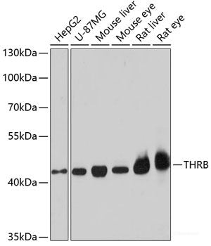 Western blot analysis of extracts of various cell lines using TSFM Polyclonal Antibody at dilution of 1:1000.