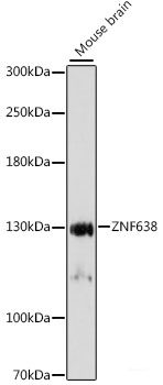 Immunofluorescence analysis of C6 cells using SYCP2 Polyclonal Antibody at dilution of 1:100. Blue: DAPI for nuclear staining.