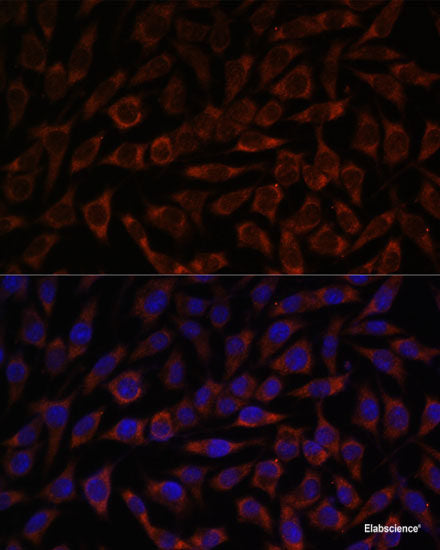 Western blot analysis of extracts of Mouse kidney using NLGN1 Polyclonal Antibody at dilution of 1:1000.