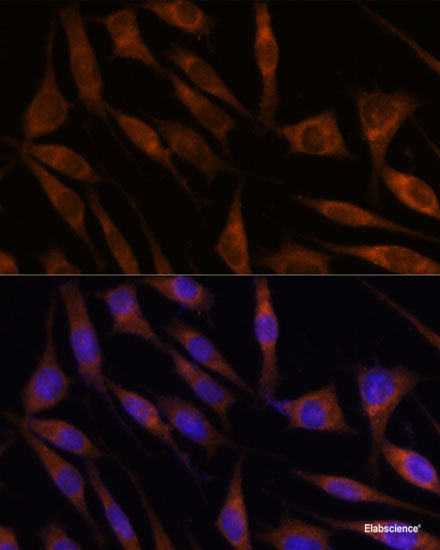 Western blot analysis of extracts of various cell lines using EPN2 Polyclonal Antibody at dilution of 1:1000.