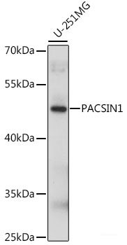 Western blot analysis of extracts of various cell lines using FBXO21 Polyclonal Antibody at dilution of 1:1000.