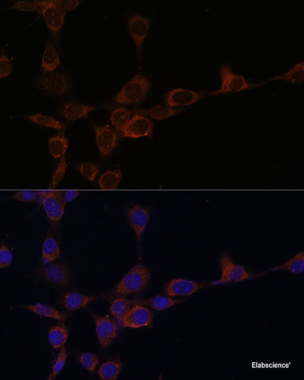 Immunohistochemistry of paraffin-embedded tonsil using HLA-DRB3 Polyclonal Antibody at dilution of 1:100 (40x lens).