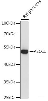 Western blot analysis of extracts of Mouse pancreas using DNTTIP2 Polyclonal Antibody at dilution of 1:1000.