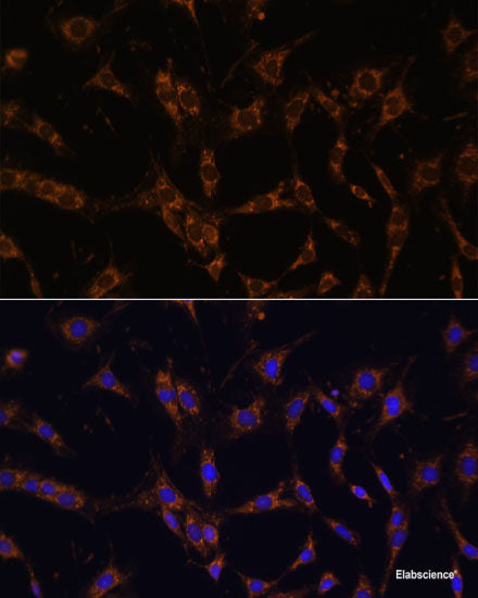 Western blot analysis of extracts of HeLa cells using IL23R Polyclonal Antibody at dilution of 1:1000.