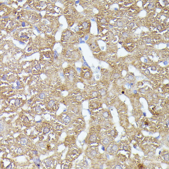 Western blot analysis of extracts of Mouse liver using LHX5 Polyclonal Antibody at dilution of 1:1000.