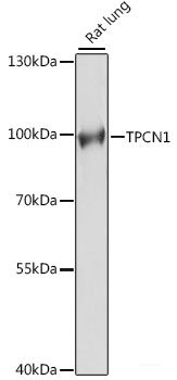 Western blot analysis of extracts of Mouse pancreas using CHID1 Polyclonal Antibody at dilution of 1:1000.