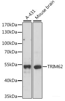 Western blot analysis of extracts of BT-474 cells using TMC5 Polyclonal Antibody at dilution of 1:1000.