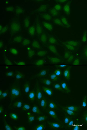 Immunohistochemistry of paraffin-embedded Rat Intestine using SPARC Polyclonal Antibody at dilution of 1:100 (40x lens).