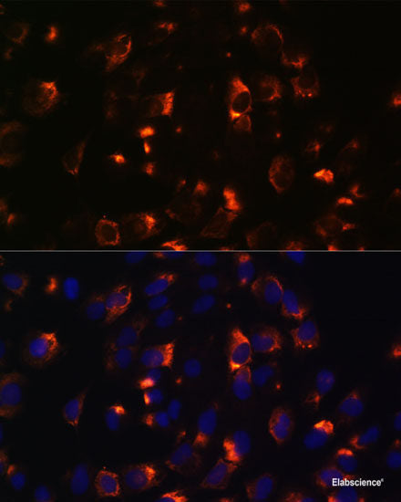 Western blot analysis of extracts of various cell lines using HPS4 Polyclonal Antibody at dilution of 1:1000.