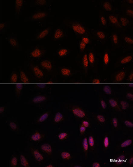 Western blot analysis of extracts of Rat heart using MYOCD Polyclonal Antibody at dilution of 1:1000.