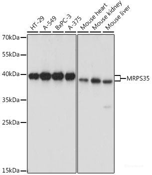 Immunofluorescence analysis of HeLa cells using CSNK2A2 Polyclonal Antibody