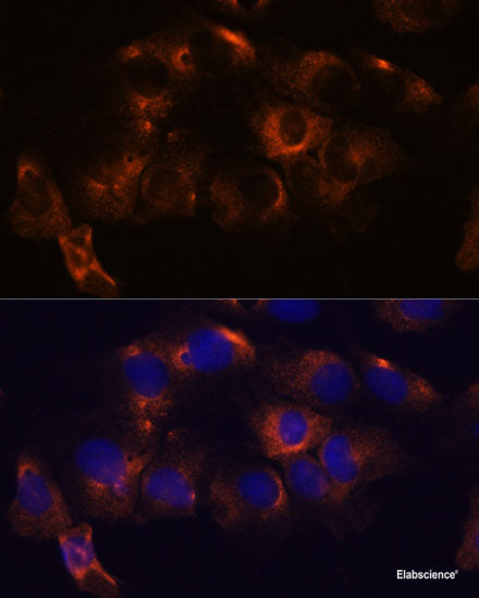 Western blot analysis of extracts of Rat brain using MEI1 Polyclonal Antibody at dilution of 1:1000.