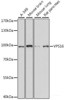 Immunofluorescence analysis of U20S cells using SGOL1 Polyclonal Antibody at dilution of 1:100. Blue: DAPI for nuclear staining.