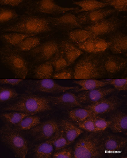 Immunofluorescence analysis of HeLa cells using PRL Polyclonal Antibody