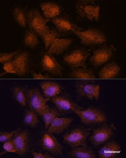 Western blot analysis of extracts of HeLa cells using USP33 Polyclonal Antibody at dilution of 1:1000.