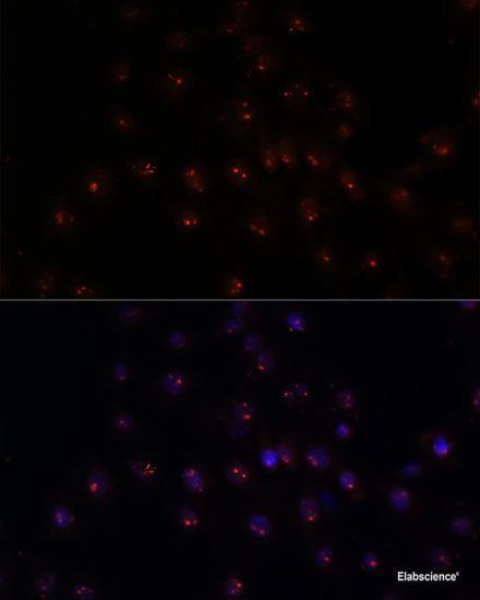 Western blot analysis of extracts of various cell lines using PADI4 Polyclonal Antibody at dilution of 1:1000.
