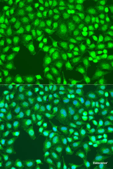 Western blot analysis of extracts of various cell lines using WBP11 Polyclonal Antibody at dilution of 1:3000.