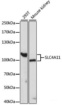 Immunofluorescence analysis of C6 cells using NDRG4 Polyclonal Antibody at dilution of 1:100. Blue: DAPI for nuclear staining.