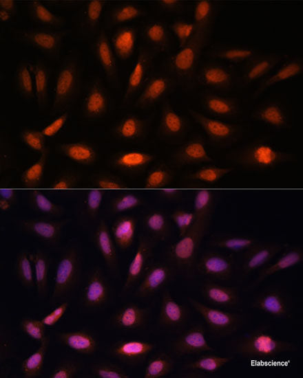Western blot analysis of extracts of Mouse thymus using ZNF620 Polyclonal Antibody at dilution of 1:1000.
