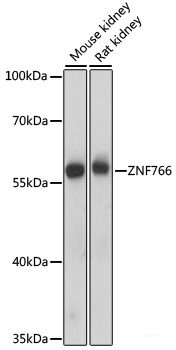 Immunohistochemistry of paraffin-embedded Rat brain using KIAA1429 Polyclonal Antibody at dilution of 1:100 (40x lens).