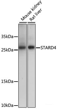 Immunofluorescence analysis of L929 cells using KCNAB2 Polyclonal Antibody at dilution of 1:100. Blue: DAPI for nuclear staining.