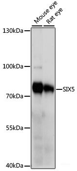 Immunohistochemistry of paraffin-embedded Human tonsil using CSNK1A1 Polyclonal Antibody at dilution of 1:100 (40x lens).