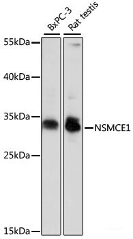Immunofluorescence analysis of MCF-7 cells using TFPI Polyclonal Antibody