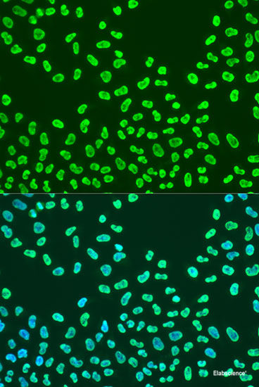 Immunofluorescence analysis of MCF-7 cells using RFC1 Polyclonal Antibody