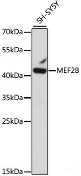Immunofluorescence analysis of C6 cells using LPL Polyclonal Antibody at dilution of 1:100. Blue: DAPI for nuclear staining.