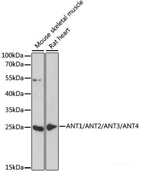 Western blot analysis of extracts of various cell lines using CSF1 Polyclonal Antibody at dilution of 1:3000.