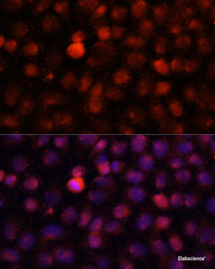 Immunohistochemistry of paraffin-embedded Human lung using WASF3 Polyclonal Antibody at dilution of 1:100 (40x lens).