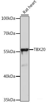 Western blot analysis of extracts of THP-1 cells using IL1 beta Polyclonal Antibody at dilution of 1:1000. THP-1 cells were treated by PMA (80 nM) at 37°C for overnight.